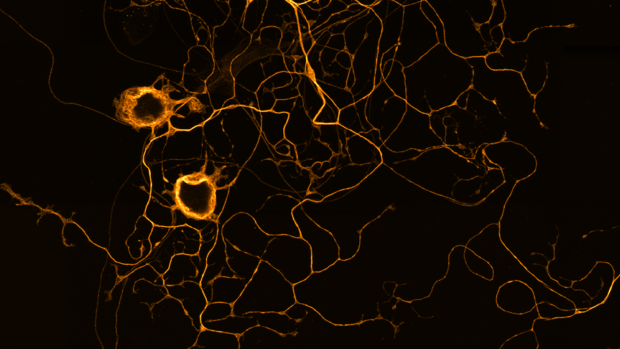 Confocal microscope image of neurons in fluorescence