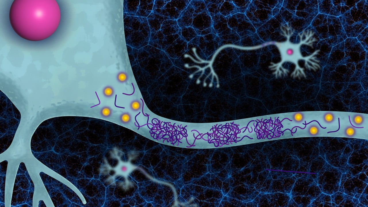 ATP prevents proteins associated with Parkinson’s disease and ALS from aggregating and becoming harmful