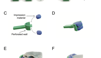 How the dental mold works