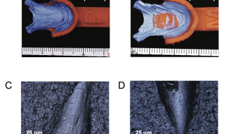 Results of fish dental impressions