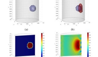 3D plots of cancerous tumor detection