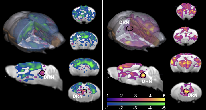 覚醒状態のマウスと麻酔状態のマウスにおける背側縫線核の活性化に対する脳の反応の比較 