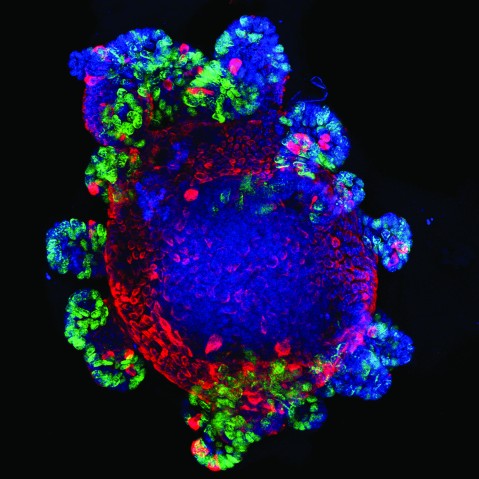 中心が青で赤い太い線で覆われた卵型の立体の周りに付着する青と黄緑の複数の球体