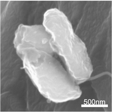 MRS damaged bacteria NanoparticlePR