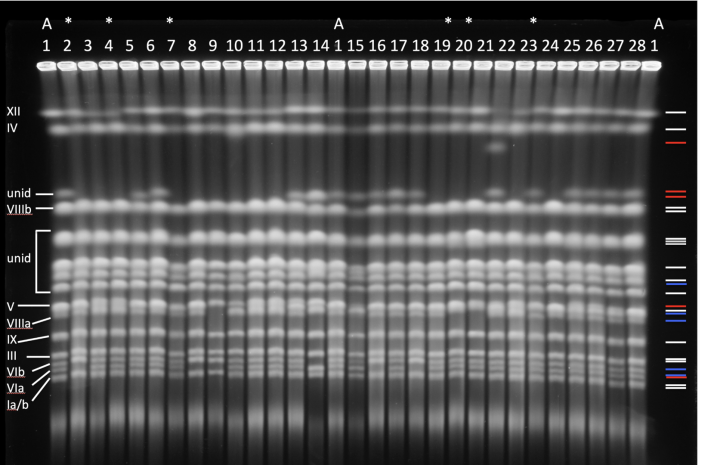 A picture of a gel with chromosomes