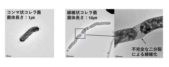 コンマ状と線維状コレラ菌