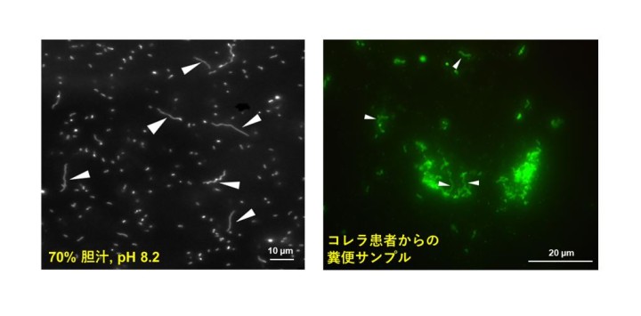 胆汁およびコレラ患者糞便サンプルから検出された線維状コレラ菌