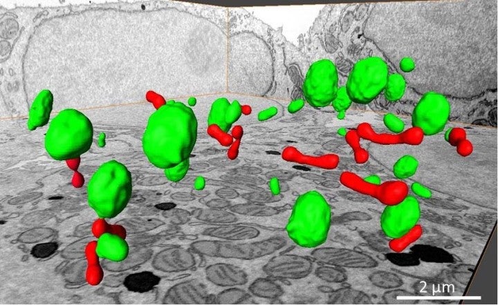 image of peroxisomal fission/multiplication
