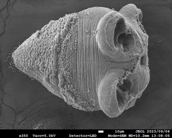 SEM photo of a Pheoreibothrium tapeworm.