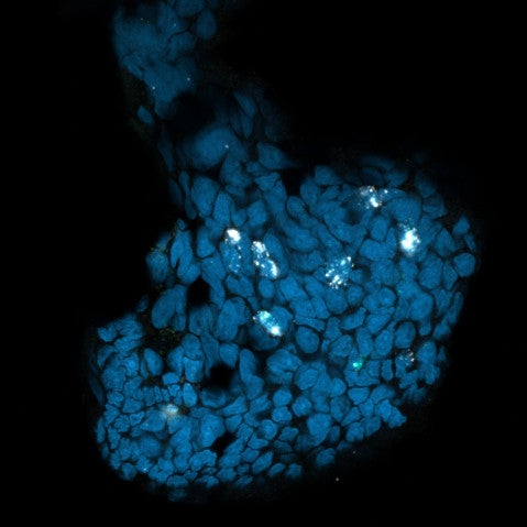 A microscope stain where blue patches reveal the sucker cups and pinpricks of white within the blue patches reveal chemotactile receptors.