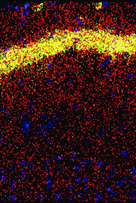 赤い粒の集まりの中に線状に横たわる黄色い粒の集まり