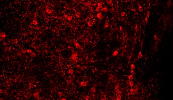 Fluorescing Neurons