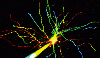 視床ニューロン