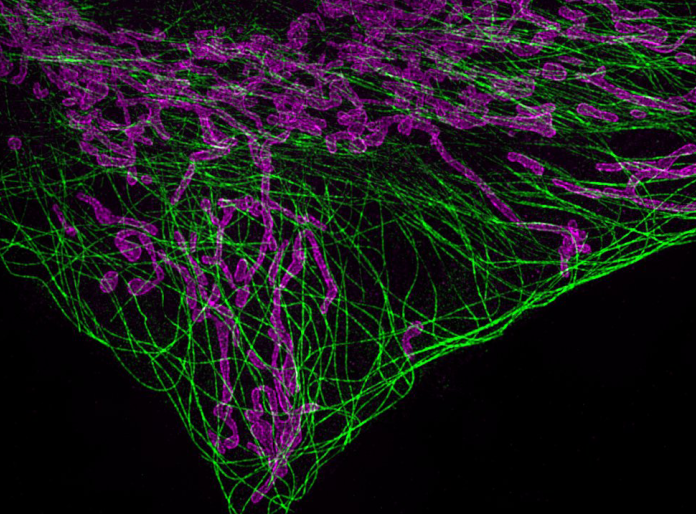 Super-resolution image of mitochondria in purple and filaments of tublin in green
