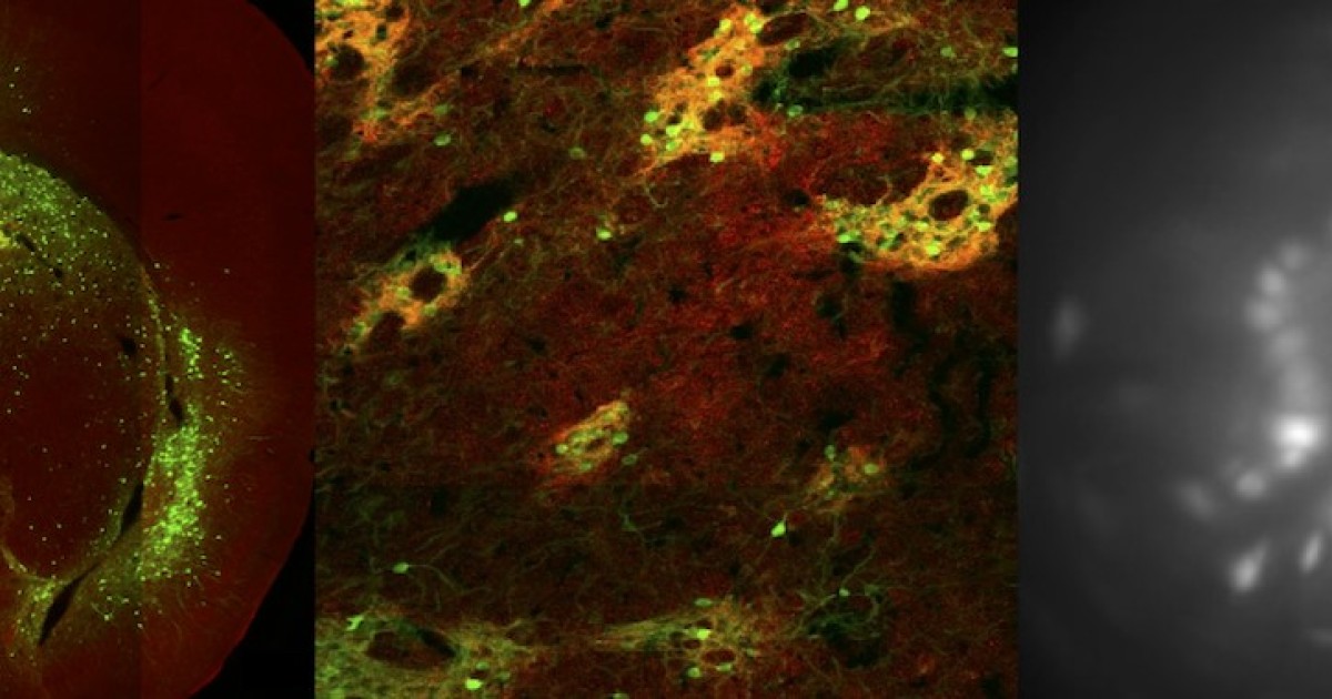 予測する脳 大脳基底核の ストリオソーム 神経細胞が学習のカギ 沖縄科学技術大学院大学 Oist